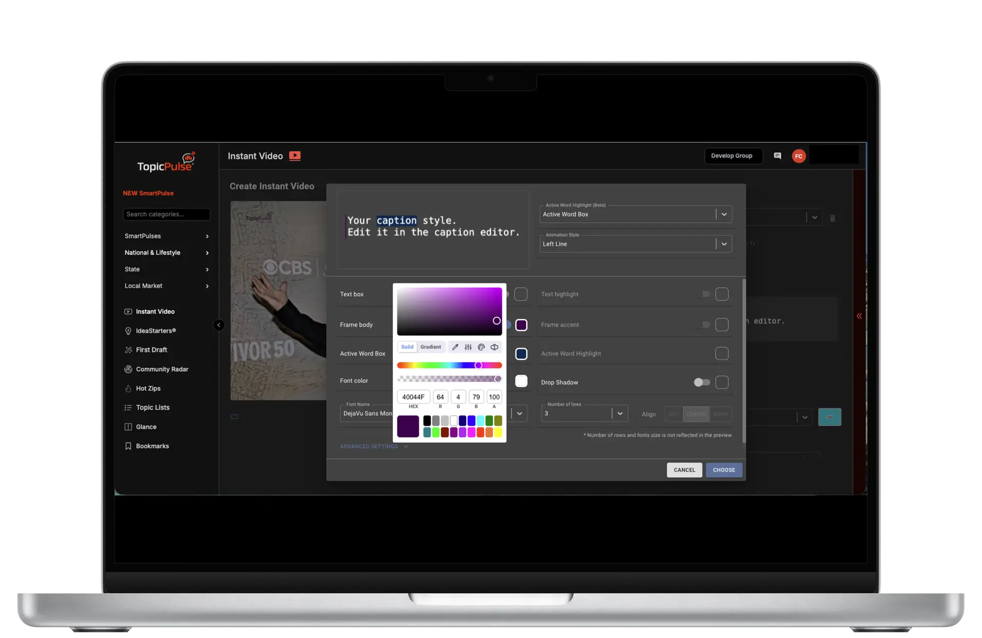 Customize Instant Video-front